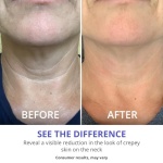 goPure Neck Firming Cream - Anti-Aging Neck Cream for Tightening and Wrinkles for an Even Skin Tone and Neck Lift - With Pro-Active Firming Complex, 1.7 oz - Image 5